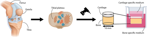 An_ex_vivo_human_osteochondral_culture_model