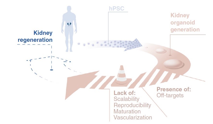 Renal_replacement_therapy_in_Regenerative_Medicine