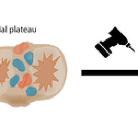 An_ex_vivo_human_osteochondral_culture_model