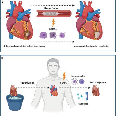 Damage-Associated_Molecular_Patterns_in_Myocardial_Infarction_and_Heart_Transplantation_The_Road_to_Translational_Success
