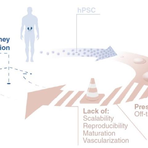 Renal_replacement_therapy_in_Regenerative_Medicine